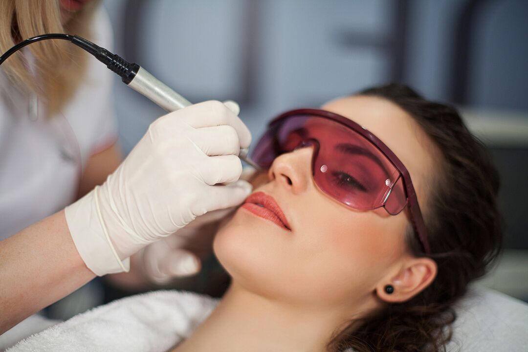 skin rejuvenation laser