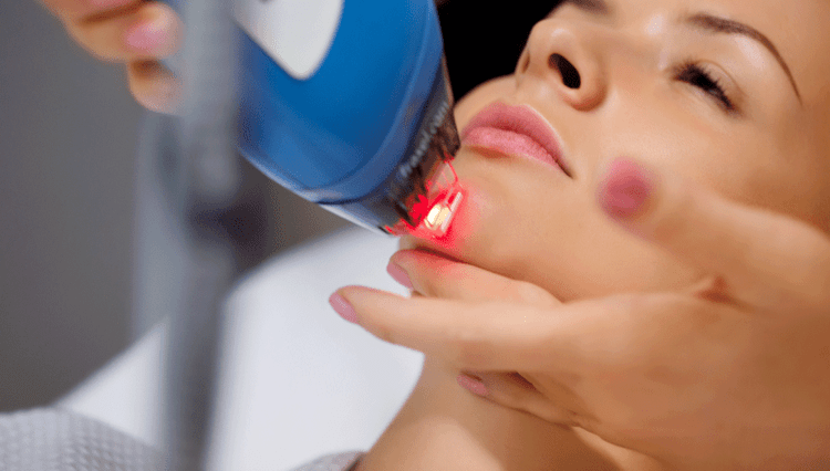 Skin rejuvenation