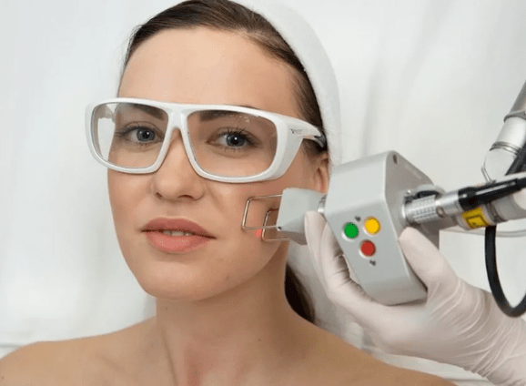 Laser rejuvenation scene