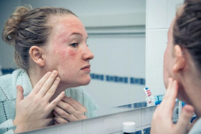Chronic skin diseases in the severe period