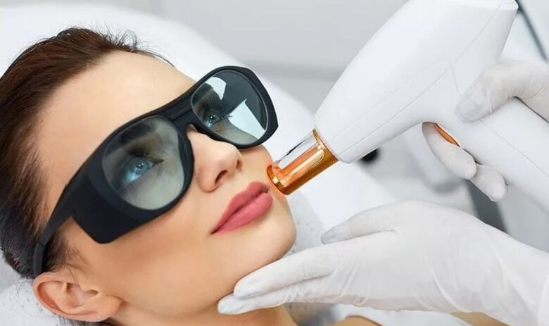 Laser rejuvenation of the skin