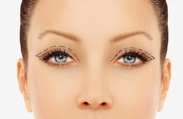 The contour of the eyelid