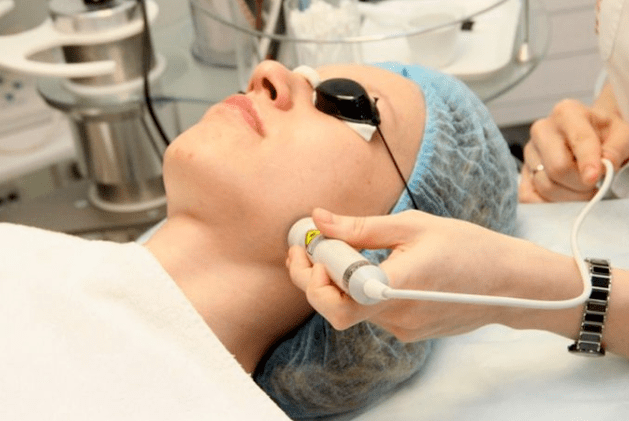 Laser Borevitalization