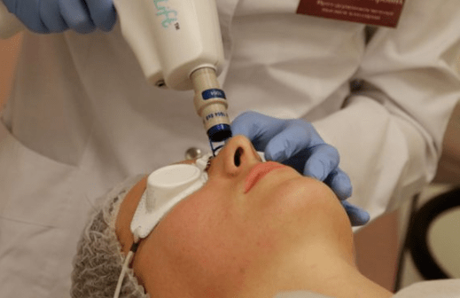 Laser rejuvenation cannot