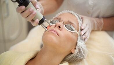 Types of fractional facial rejuvenation
